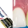 Memutihkan Gigi dengan Pepsodent