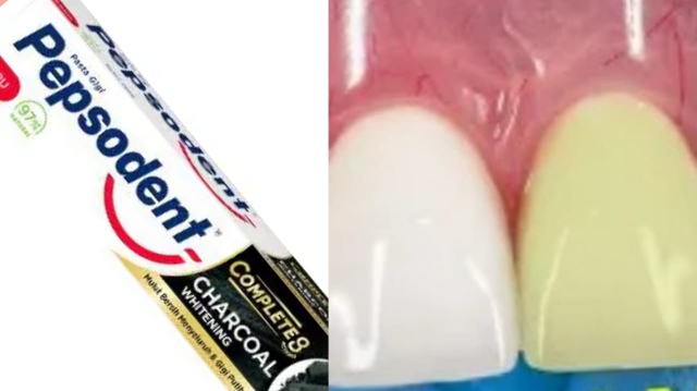 Memutihkan Gigi dengan Pepsodent