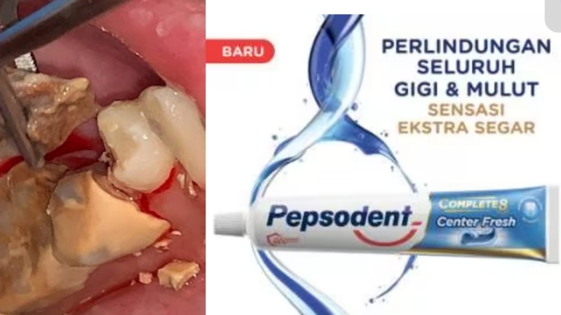 Pepsodent Penghilang Karang Gigi