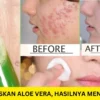 aloe vera gel untuk wajah glowing