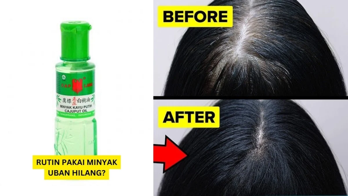 cara memakai minyak kayu putih untuk rambut