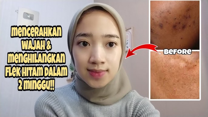 cara membuat masker lidah buaya untuk menghilangkan flek hitam