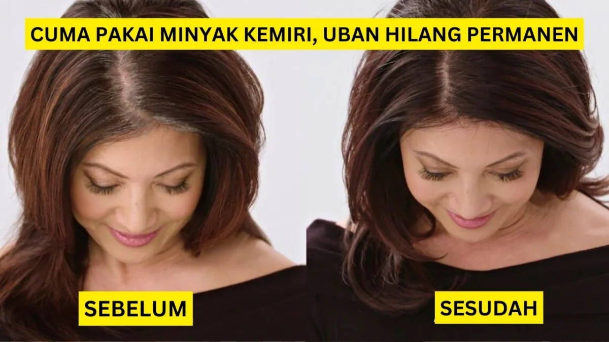 cara membuat minyak kemiri untuk rambut beruban