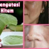 cara mengatasi flek hitam dengan aloe vera