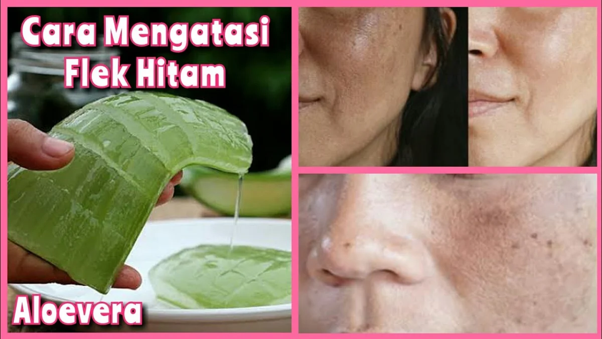 cara mengatasi flek hitam dengan aloe vera