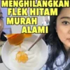 cara menghilangkan flek hitam alami