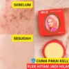 cara menghilangkan flek hitam dengan kelly