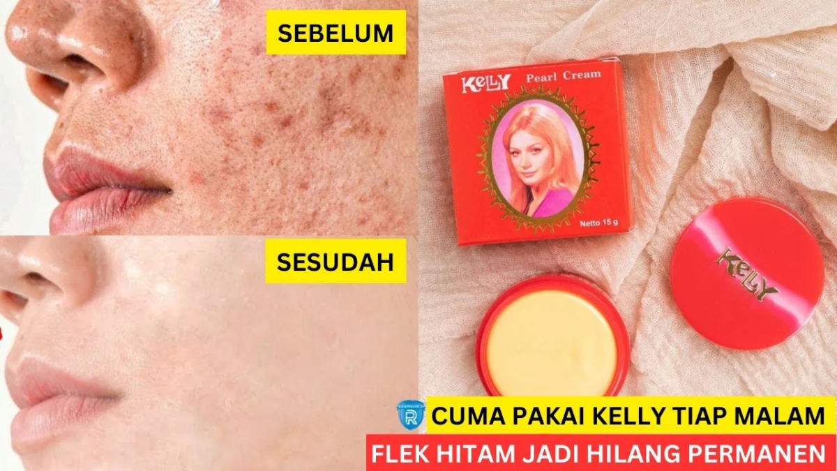 cara menghilangkan flek hitam dengan kelly