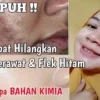 cara menghilangkan flek hitam secara alami