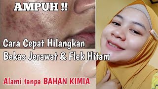 cara menghilangkan flek hitam secara alami