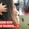 cara menghilangkan kutu rambut