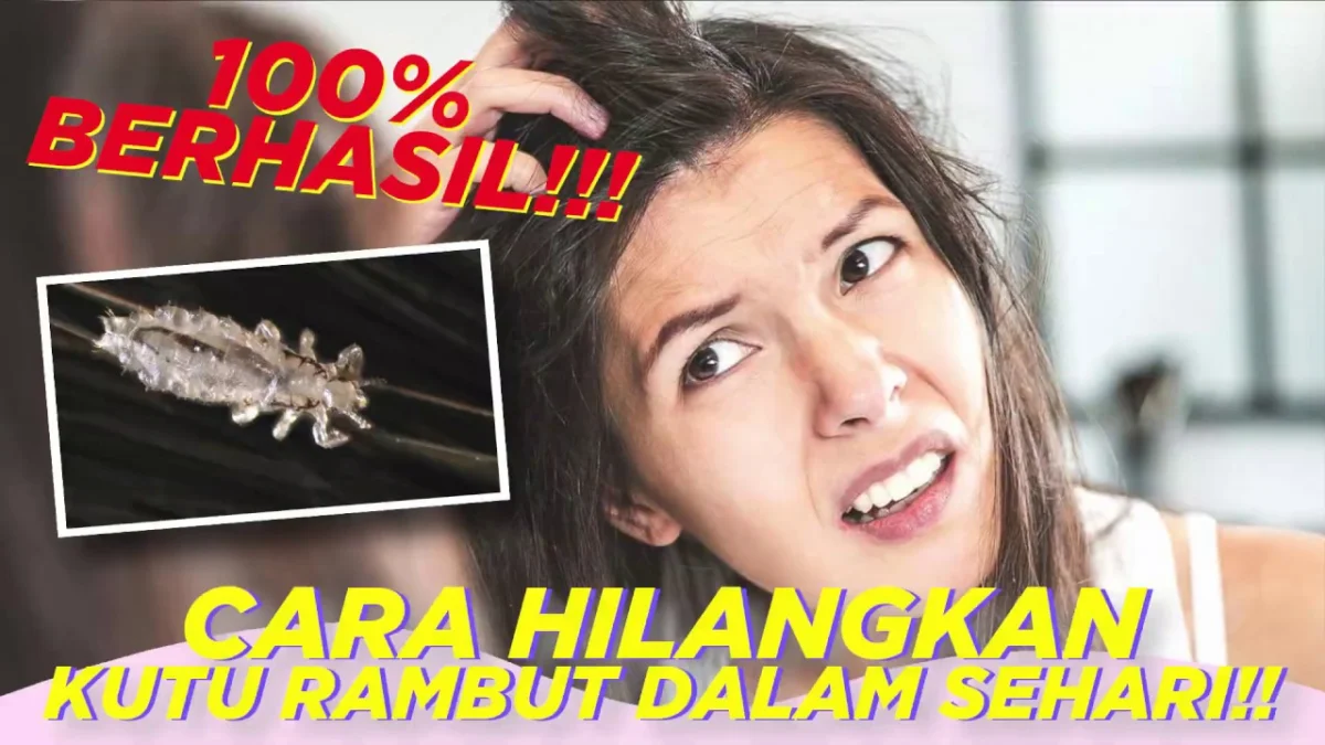 cara menghilangkan kutu rambut dengan cepat