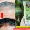 cara menghitamkan rambut beruban dengan lidah buaya