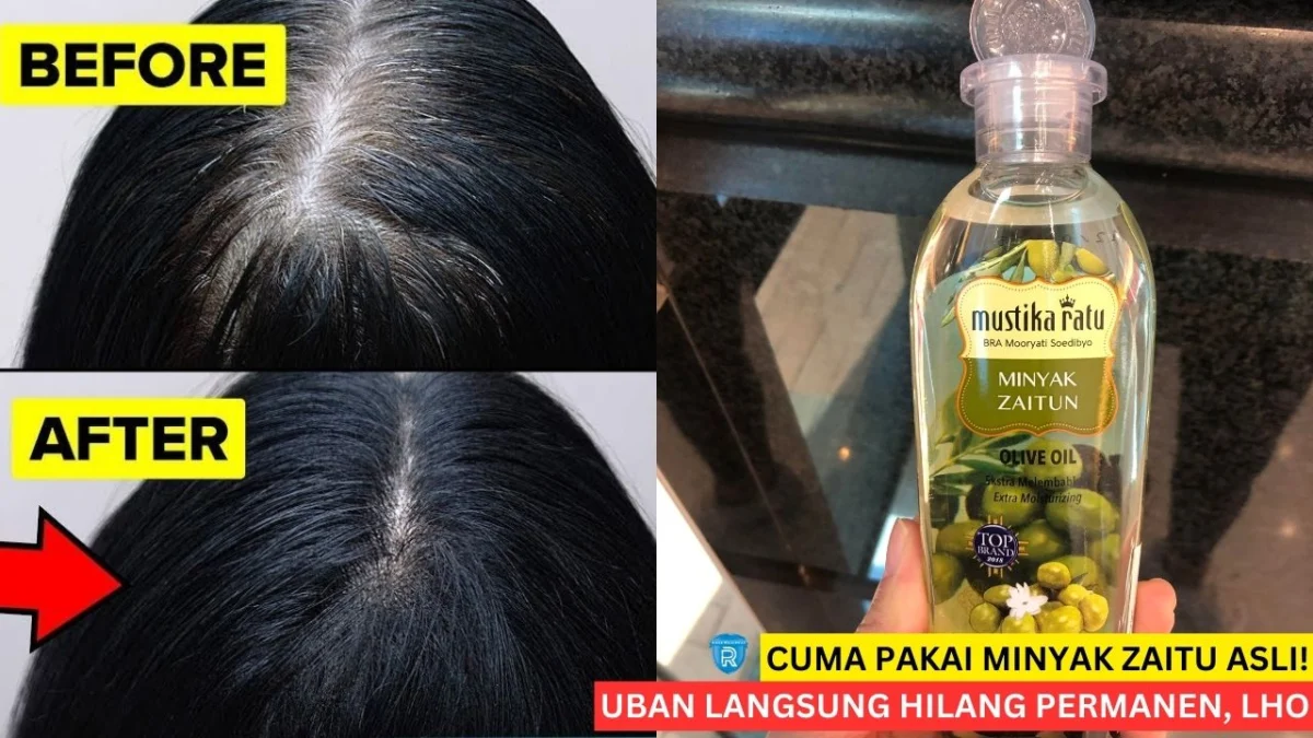 cara menghitamkan rambut beruban dengan minyak zaitun