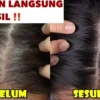 cara menghitamkan rambut dengan cepat