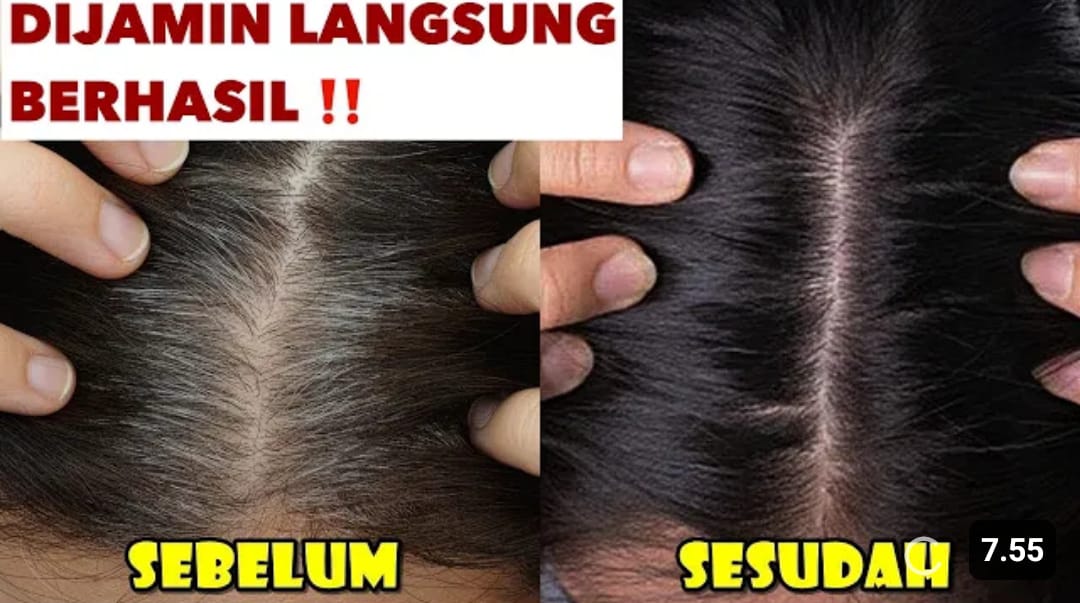 cara menghitamkan rambut dengan cepat