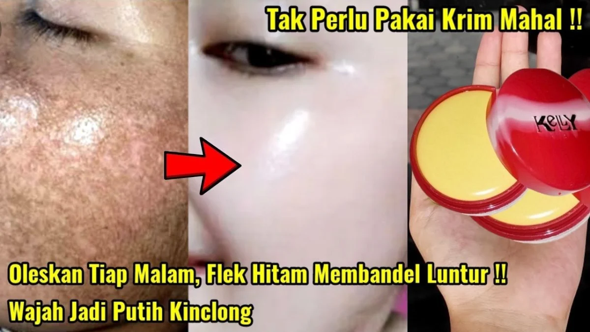 cream kelly untuk flek hitam