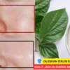 daun sirih buat masker wajah