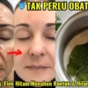 daun sirih untuk wajah