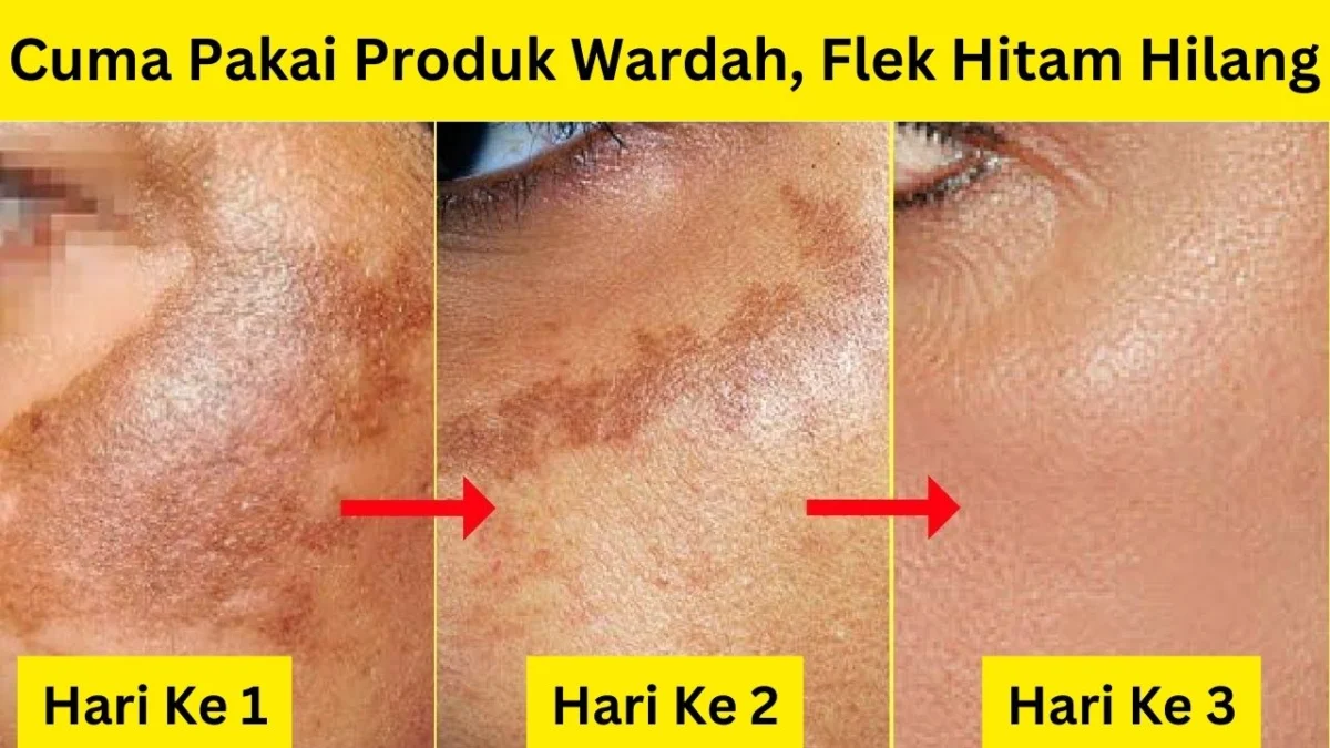 krim siang malam wardah untuk menghilangkan flek hitam