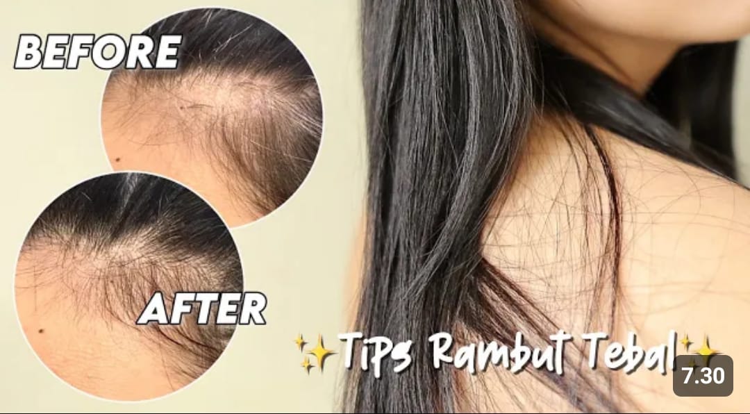 lidah buaya untuk rambut rontok