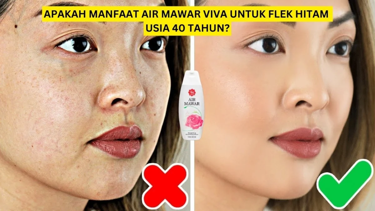 manfaat air mawar viva untuk flek hitam usia 40 tahun