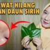 manfaat daun sirih untuk wajah