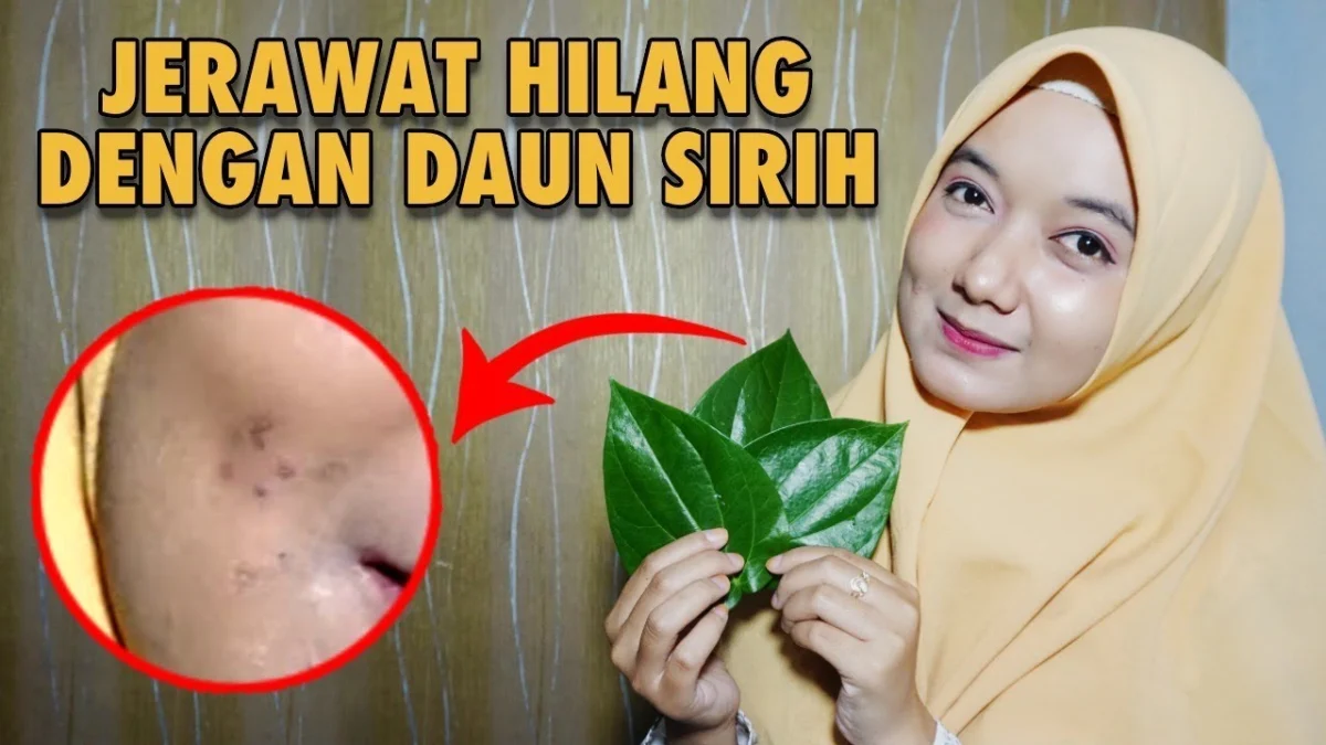 manfaat daun sirih untuk wajah