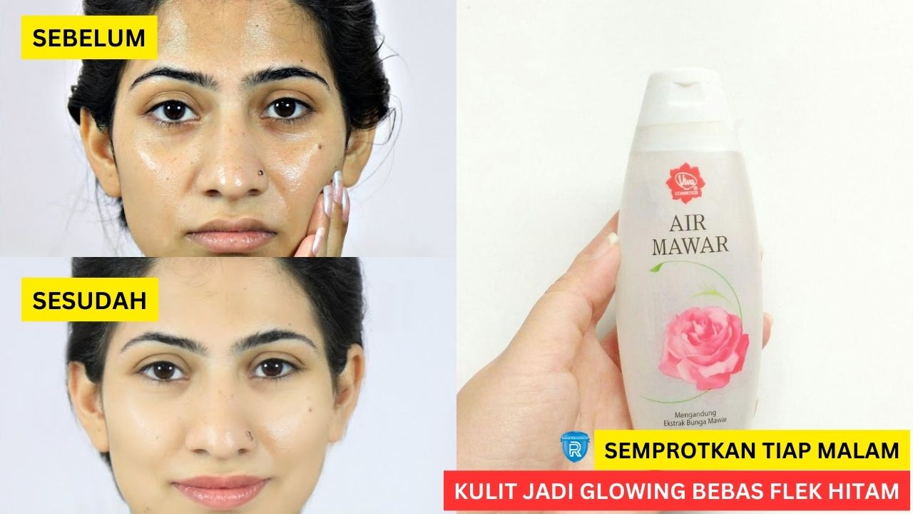 Mau Kulit jadi Glowing Bebas Flek Hitam? Ini 5 Manfaat Viva Air Mawar