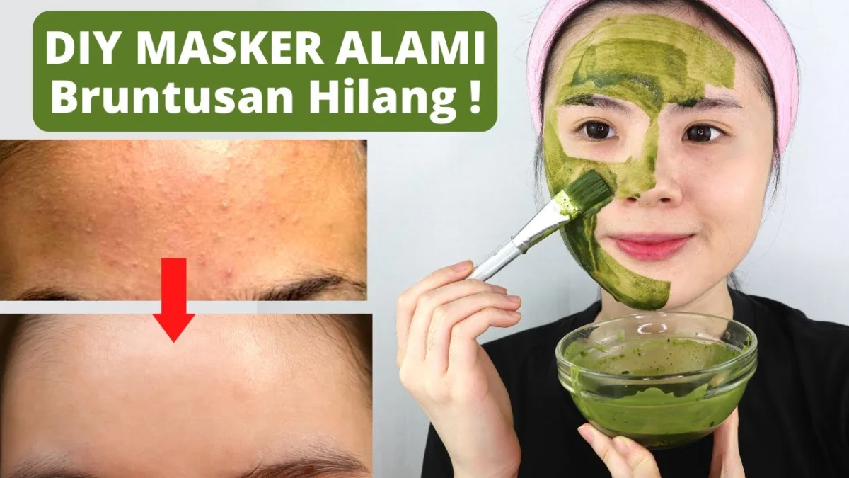 Cara Menggunakan Masker Teh Hijau untuk Menghilangkan Jerawat