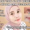 mencerahkan bibir hitam