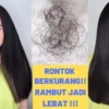 mengatasi rambut rontok parah