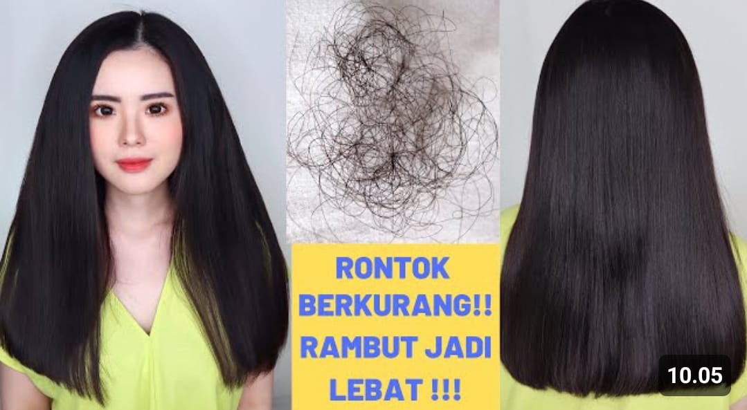 mengatasi rambut rontok parah