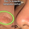 menghilangkan komedo di hidung secara alami