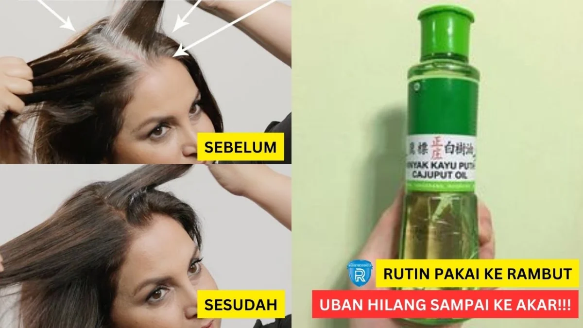 minyak kayu putih hilangkan uban