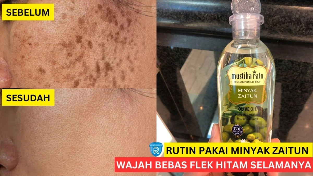 minyak zaitun untuk wajah flek hitam