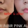 pencerah bibir hitam