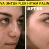 produk viva untuk flek hitam