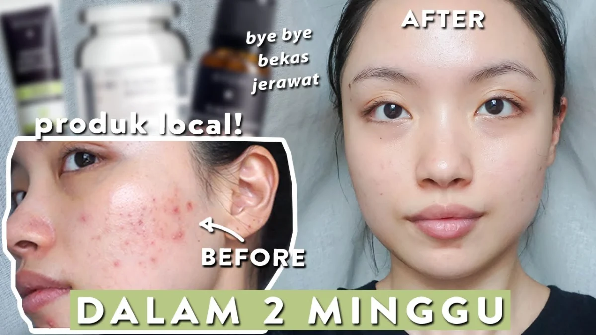 skincare lokal untuk menghilangkan komedo dan mengecilkan pori-pori