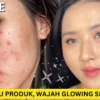 skincare untuk mengecilkan pori-pori dan menghilangkan komedo