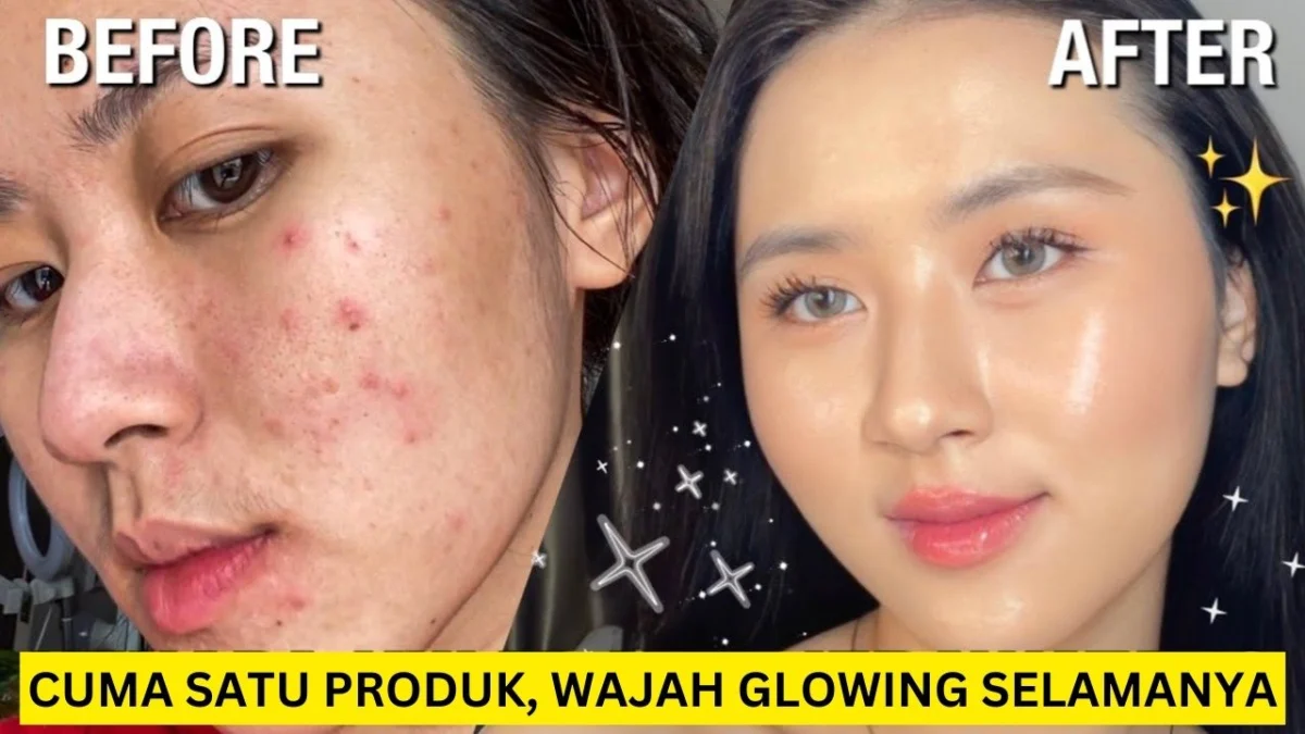 skincare untuk mengecilkan pori-pori dan menghilangkan komedo