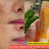 sunscreen buat flek hitam usia 40 tahun ke atas