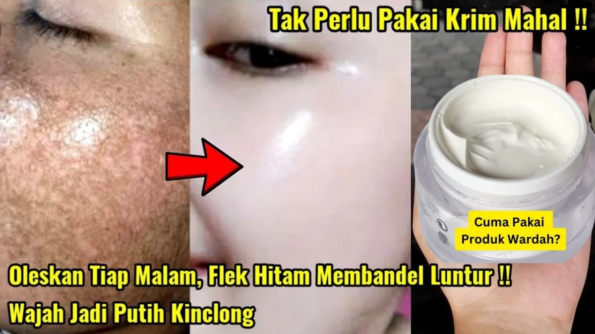 wardah penghilang flek hitam