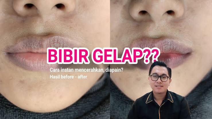 cara alami membuat bibir cerah merona