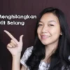 cara menghilangkan kulit belang