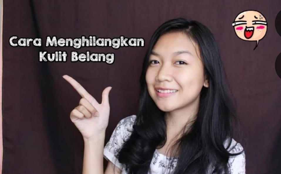 cara menghilangkan kulit belang