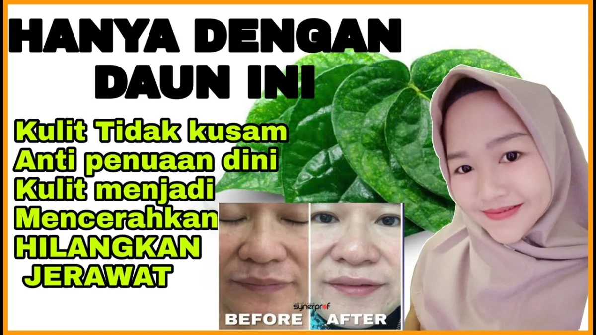 daun sirih untuk wajah berjerawat