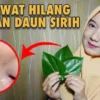 khasiat daun sirih untuk wajah