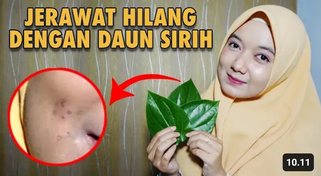 khasiat daun sirih untuk wajah