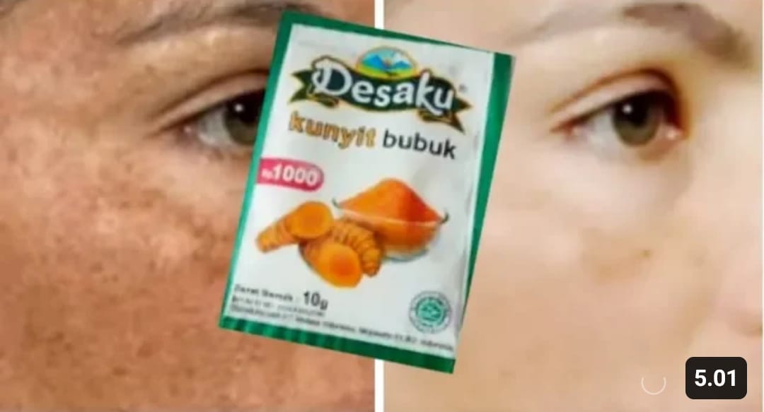 kunyit untuk wajah